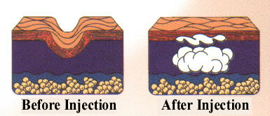 collagen cartoon.jpg (64784 bytes)