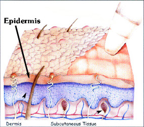 Microdermabrasion cartoon.jpg (65161 bytes)