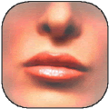 Restylane