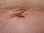Titan ABD Before Picture