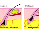 Laser Hair Removal Clinic By New Look Laser Clinic, New Delhi.