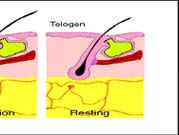 Laser Hair Removal Clinic By New Look Laser Clinic, New Delhi.
