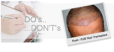 FUE Post OP Instructions